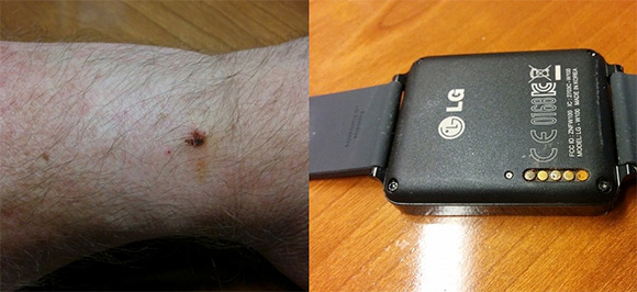 Korrodálódik néhány LG G Watch toltőcsatlakozója
