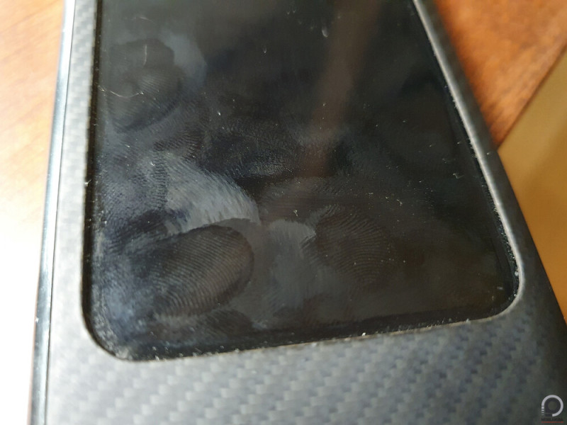 Ez nem csak randa látvány, de hemzsegnek rajta a kórokozók.