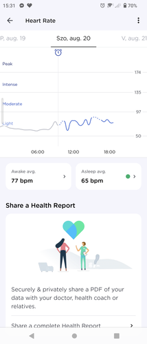 EKG, véroxigénszint és pulzus a ScanWatch Horizon által mérve.