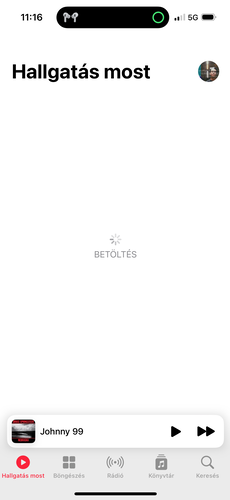 Animációk a dinamikus szigeten: visszaszámlálás, csatlakoztatott fülhallgató, lejátszás vezérlője