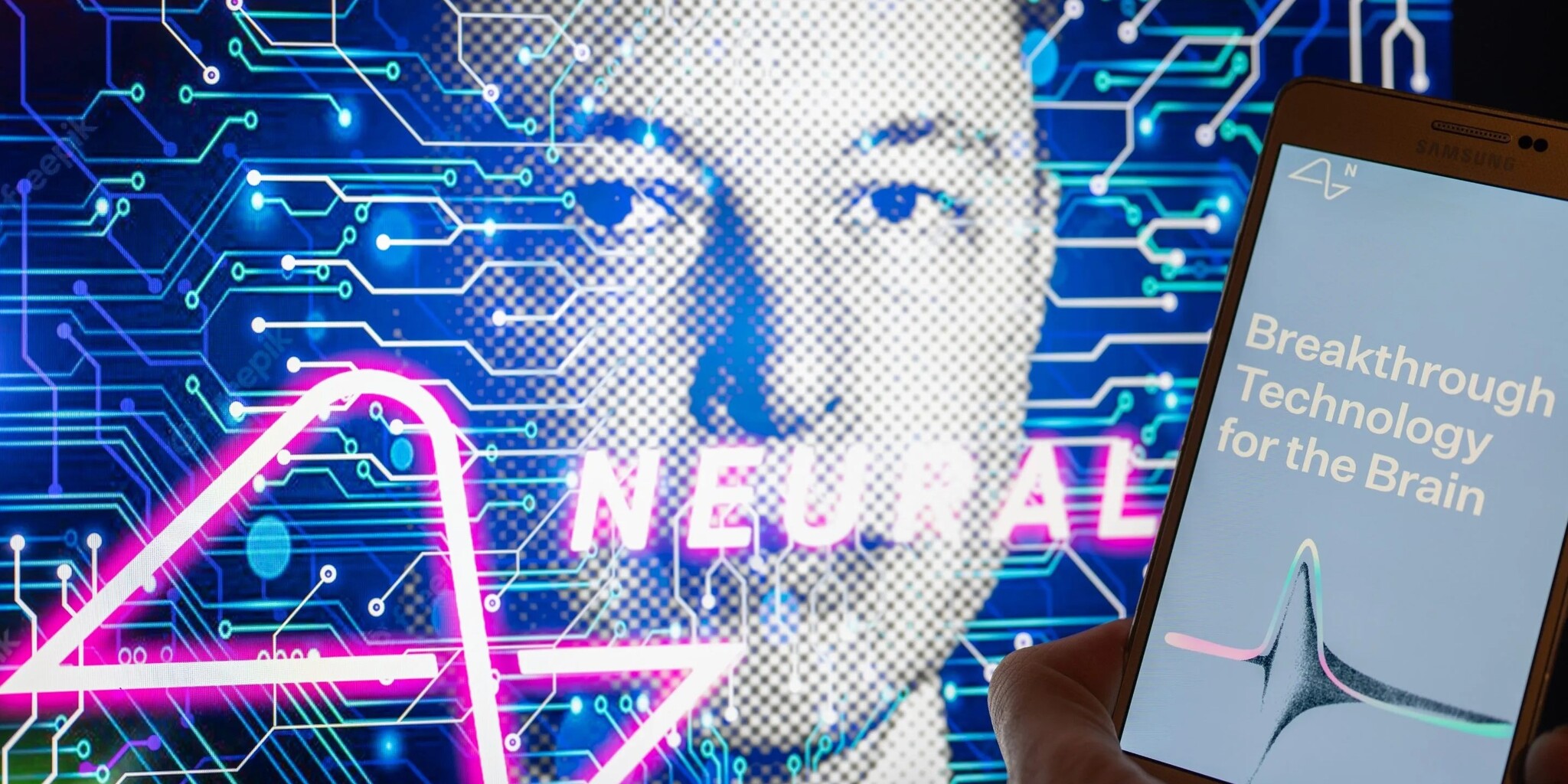 Emberbe ültették a Musk-féle Neuralink agyi chipet