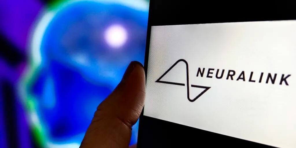 Musk azt mondja: a gondolatával mozgatja az egeret a Neuralink első betege